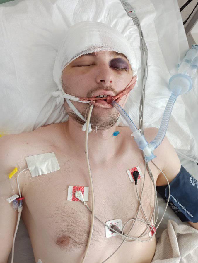 Фото (2) госпитализированного. Источник - Фейсбук